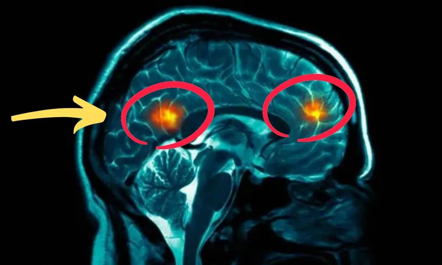 Watch presentation: how to stop ringing in ears